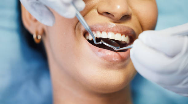 Best Emergency Treatment for Dental Infections or Abscesses in South Milwaukee, WI